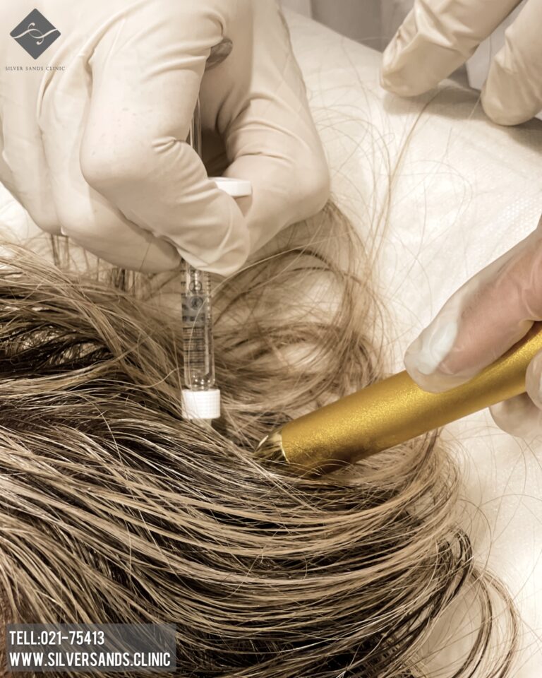 ریزش موی تیروئیدی و راهکارهای درمان